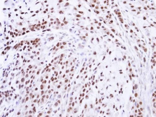 ZNF346 Rabbit Polyclonal Antibody