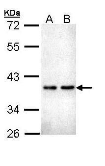 ZNF346 Rabbit Polyclonal Antibody