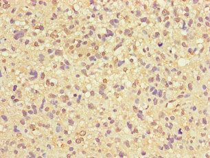 ZNF365 Antibody