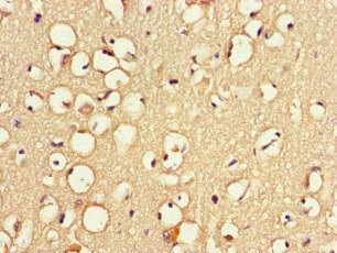 ZNF365 Antibody