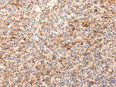 ZNF365 Antibody