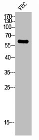 ZNF384 Antibody