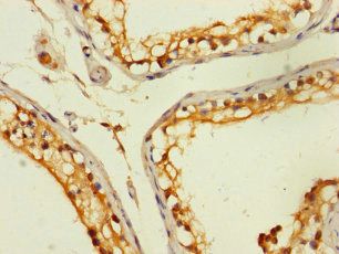 ZNF562 Antibody