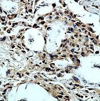 ZNF77 Rabbit Polyclonal Antibody
