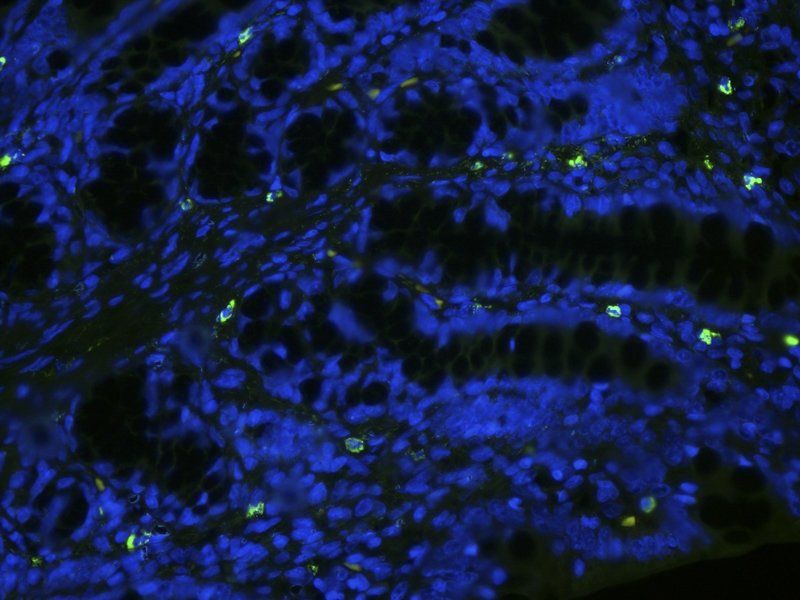 ZO-1 Rabbit Polyclonal Antibody (FITC)
