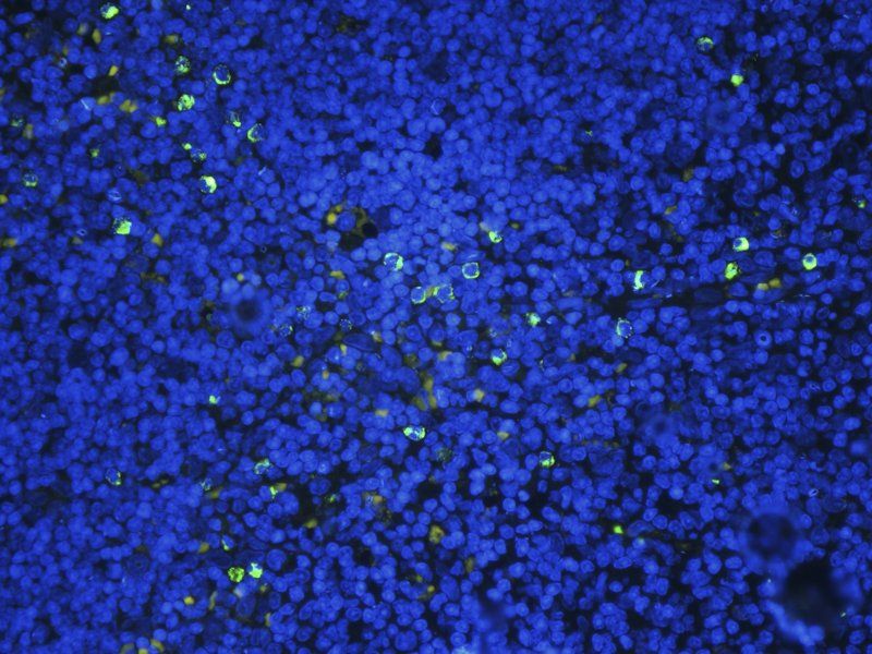 ZO-1 Rabbit Polyclonal Antibody (FITC)