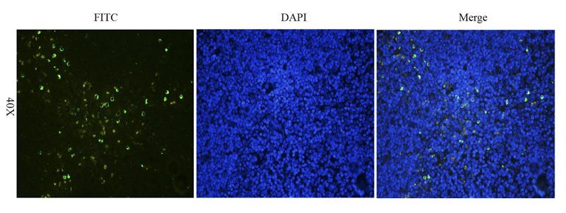 ZO-1 Rabbit Polyclonal Antibody (FITC)