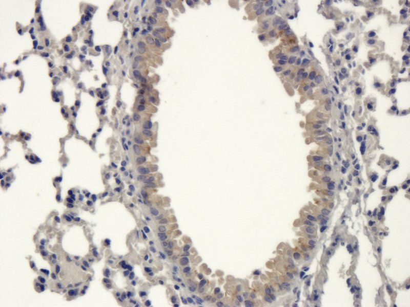 ZO-1 antibody