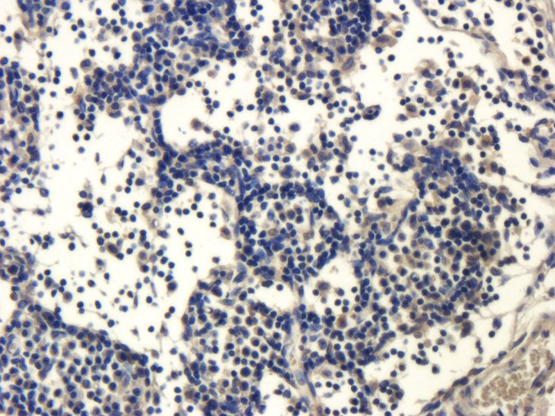 ZO-1 antibody