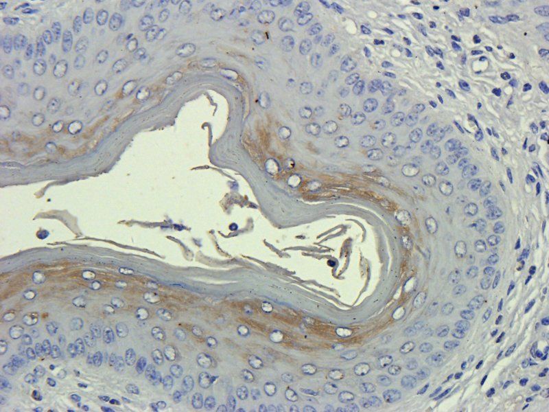 ZO-1 Rabbit Polyclonal Antibody