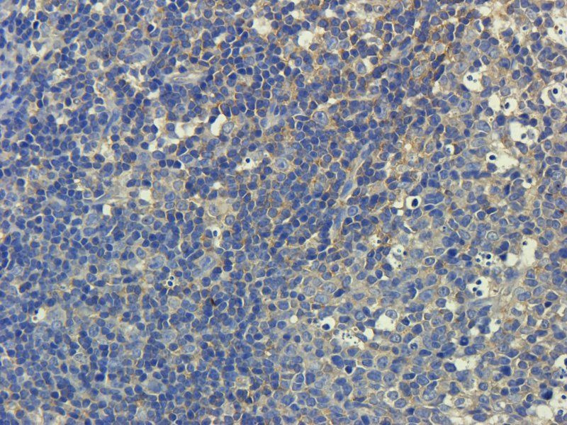 ZO-1 Rabbit Polyclonal Antibody
