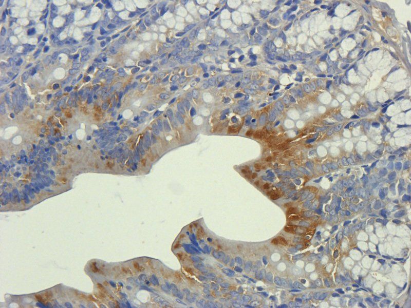 ZO-1 Rabbit Polyclonal Antibody