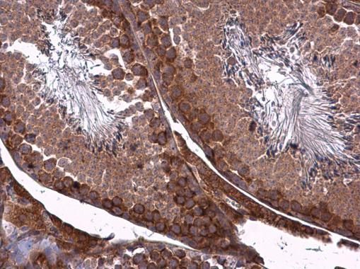 ZO-1 antibody [N1N2], N-term