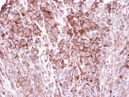 ZO-1 antibody [N1N2], N-term