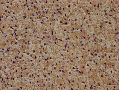 ZRANB1 Antibody