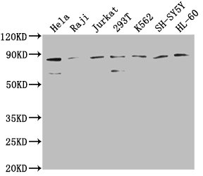 ZRANB1 Antibody