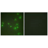 ZRANB2 Antibody
