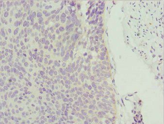 ZSCAN26 Antibody