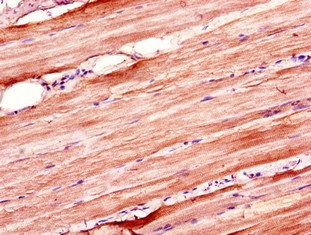 ZSWIM6 Antibody